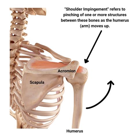 What Is Shoulder Impingement Fix It Without Surgery — Evolve Flagstaff