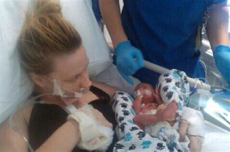 Woman Gives Birth In Coma After Stroke Daily Star