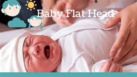 Baby Flat Head When To Worry Professionals Advice