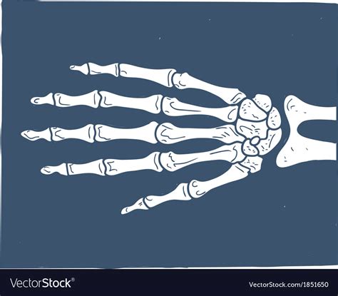 X Ray Hand Clip Art