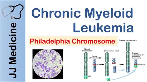 Chronic Myelogenous Leukemia Pathway