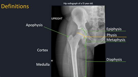 Approach To Musculoskeletal Radiology Youtube