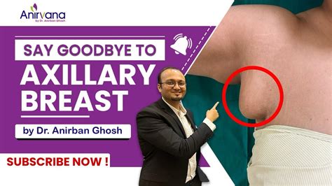 Axillary Breast Removal Axilla Breastreductionsurgery Cosmeticsurgery Dranirbanghosh Youtube