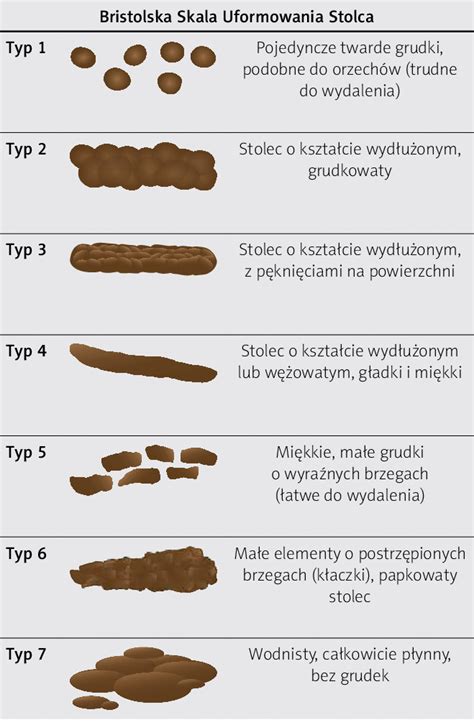Bristol Stool Form Scale Adapted To Polish Download Scientific Diagram