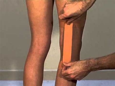 Before you start doing any of the suggested exercises, it is important to consult your doctor first. Effective sports taping to limit hyperextension of the ...