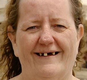 Toothless Grandmother 48 Who Called Herself Fat And Ugly Is