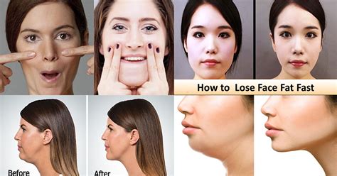 Losing Face Fat How To Lose Face Fat Yes It Will Take You Some