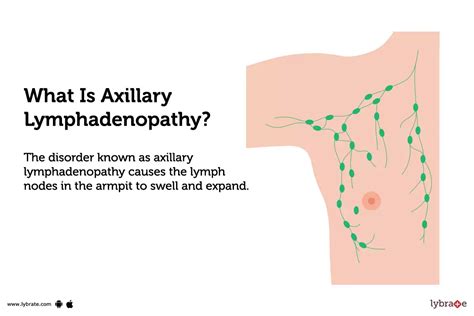 Axillary Lymphadenopathy Causes Symptoms Treatment And Cost