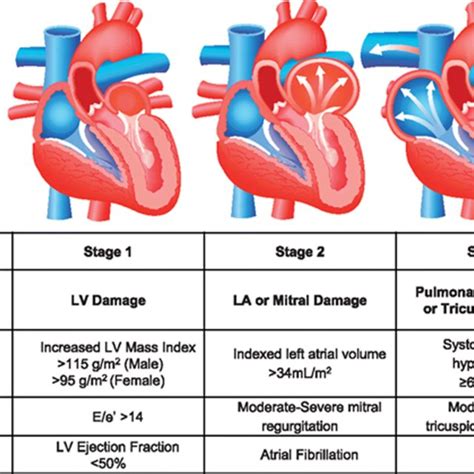 Staging Classification Of Aortic Stenosis Based On The Extent Of