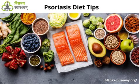 Psoriasis Diet Tips Ways To Treat Psoriasis At Home Guides King