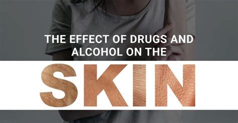 The Effect Of Drugs And Alcohol On The Skin