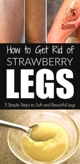 How To Get Rid Of Strawberry Legs Fast Like A Boss Easy Regimen And At