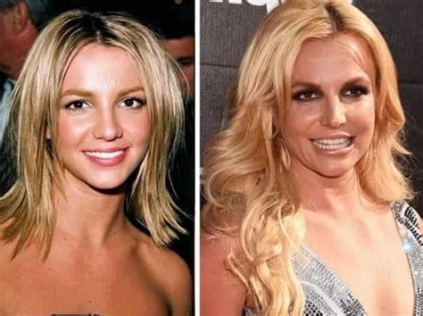 The Most Expensive Celebrity Plastic Surgeries Ever And How Much They Cost Celebrity Plastic