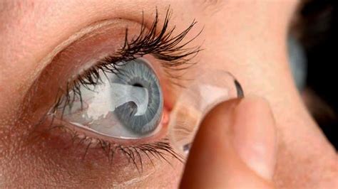 Doctors Remove Contact Lenses Lodged In Womans Eye Youtube