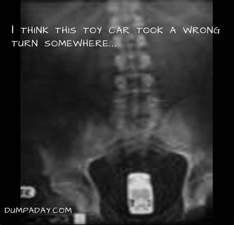 Dump A Day Amazing X Rays Of Random Objects Inserted Into Bizarre Places Pics Xray Humor