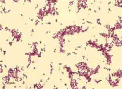 Gram Stain From Colonies Showed Short Gram Positive Rods