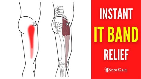 How To Relieve Iliotibial Band Pain For Good Youtube