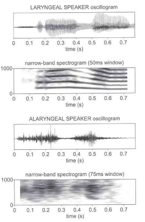 Oscillograms And Narrow Band Spectrograms Of The Utterance Vrij Warm