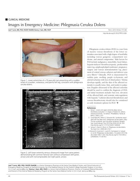 Pdf Images In Emergency Medicine Phlegmasia Cerulea Dolens