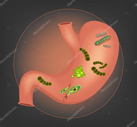 Human Stomach With Germs And Bacteria Vector Illustration — Stock