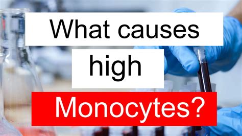 What Causes High Monocytes And Low Phosphate