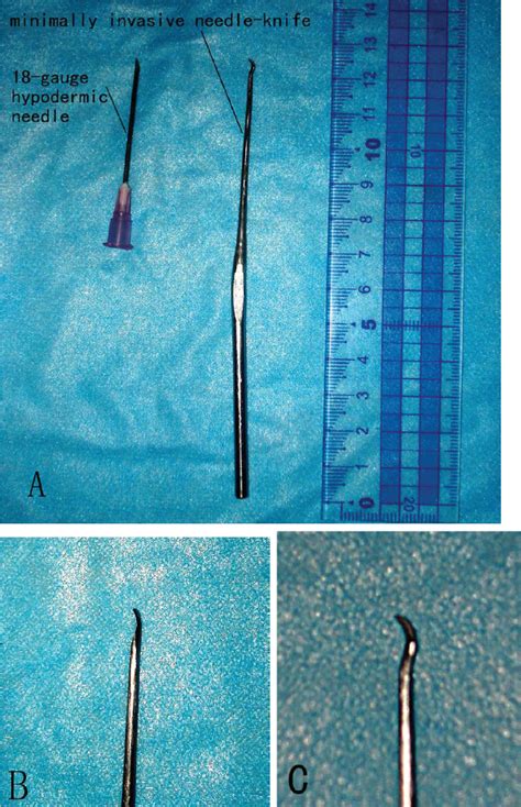Figure 1 From Development Of A Special Needle Knife For Percutaneous A1