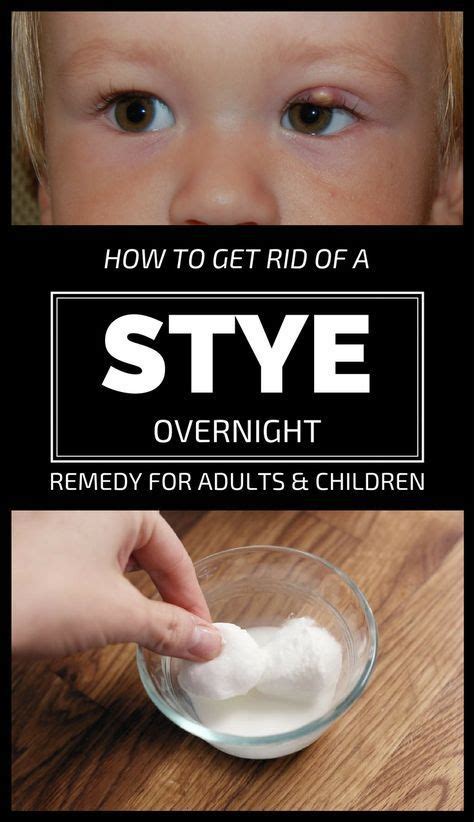 9 Best Stye Treatment Ideas Stye Treatment Stye Eye Stye Remedies