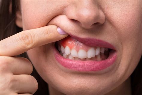 What Causes Swollen Gum Around One Tooth