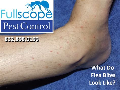 What Do Flea Bites Look Like Fullscope Pest Control