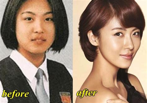 That's very veryyyy unlikely (kinda impossible)… she is only 16 (international age), and in south korea, the age limit for major plastic surgeries is 18. Who Are The Koreans - Page 8 - Historum - History Forums