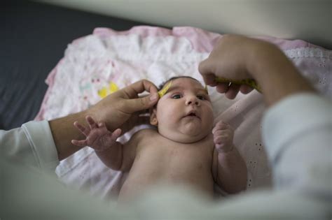 Rise In Babies Born With Small Heads Linked To Zika Virus