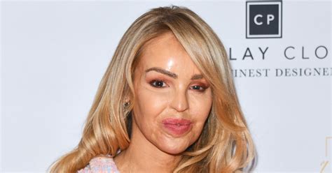 katie piper s acid attacker on the run as police launch urgent appeal to find him daily star