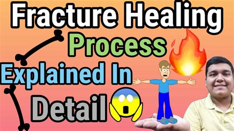 Following a fracture, cell migration, cell/tissue differentiation, tissue synthesis, and cytokine and growth factor release occur, regulated by the mechanical. Fracture/Bone Healing Process Explained - YouTube