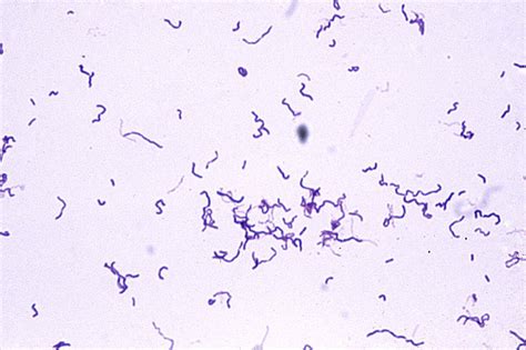 Listeria Monocytogenes Rash Microbiology Ex 4 Infections Of The