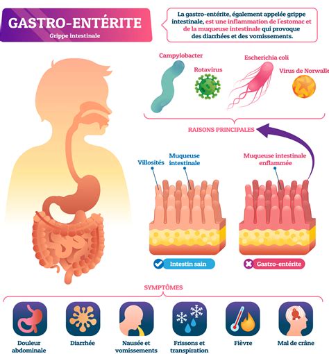 Gastro Entérite Bébé Causes Symptômes Et Traitements Naturels
