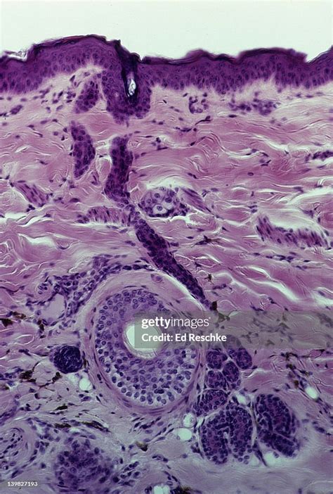 Sweat Gland Duct On Human Scalp Leading To Surface Crosssection Of A