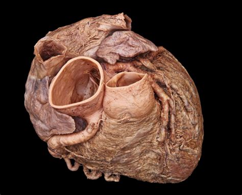 Cadaver Heart Superior View Diagram Quizlet