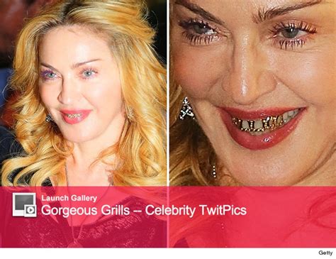 Madonna Flashes Her Grill In Rome How Ridiculous Is This