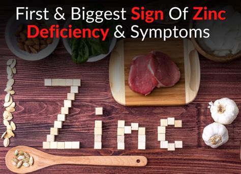 Symptoms Of Zinc Deficiency Dr Sam Robbins