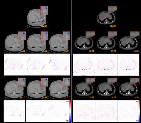 comparison of limited angle reconstructions 120 limited angle and download scientific