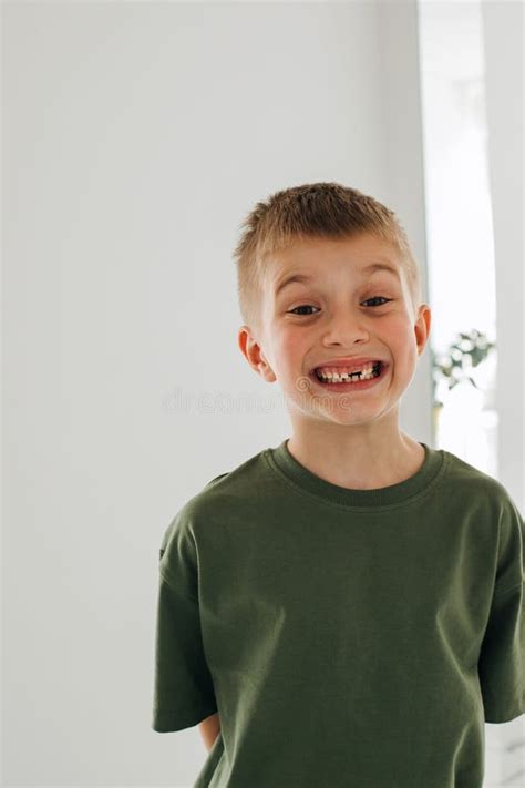 A Joyful Boy Is Standing In A Dental Clinic And Showing His Teeth Boy