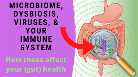 Microbiome Dysbiosis Viruses And Your Immune System How These Affect