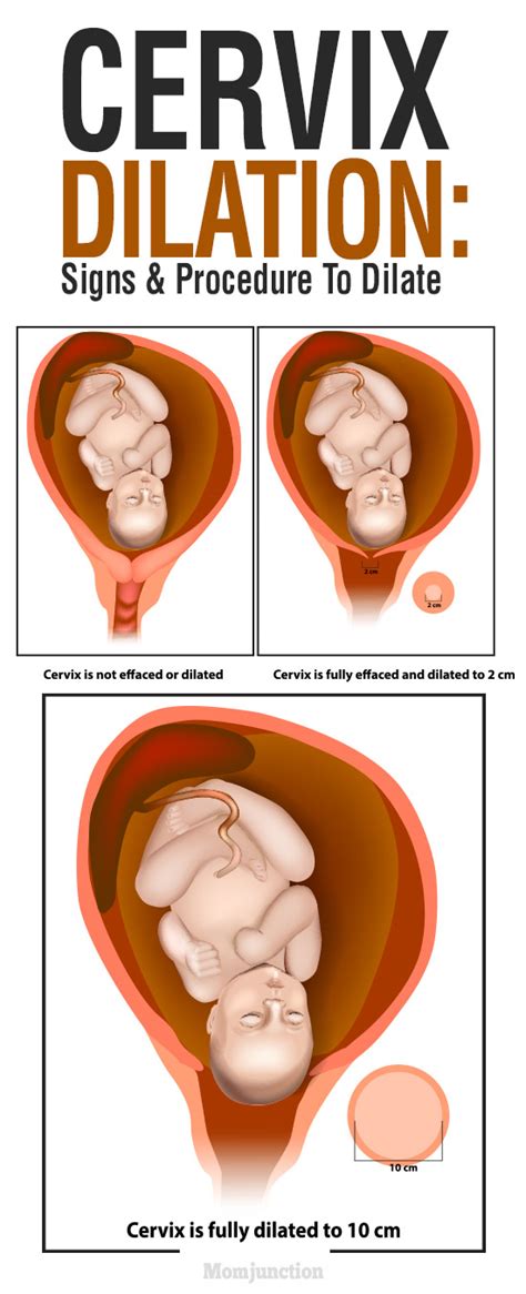 cervix dilation signs and procedure to dilate