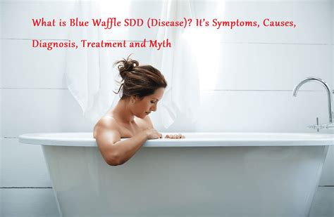 What Is Blue Waffle Sdd Disease It’s Symptoms Causes Diagnosis Treatment And Myth