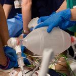 Prolonged Cpr Efforts May Be Beneficial Study Says The New York Times