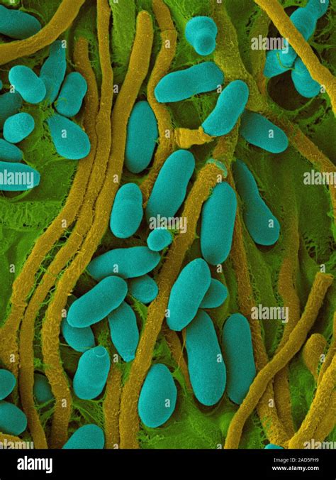 Coloured Scanning Electron Micrograph Sem Of Acremonium Stromaticum