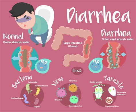 What Is Diarrhea Causes Symptoms And Home Remedies