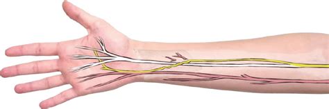 Anterior Interosseous Nerve Ain To Ulnar Deep Motor Transfer The Ain