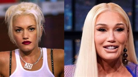 Gwen Stefani’s Plastic Surgery Interview Reddit Users Are Interested To Know About Her Cosmetic