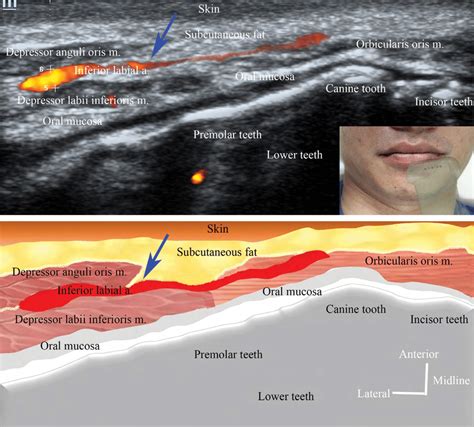 Ultrasound Image And Relating Illustration Of The Main Inferior Labial